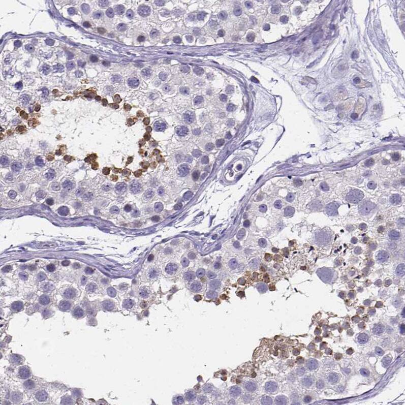 Staining of human testis shows weak to moderate cytoplasmic positivity in spermatids.