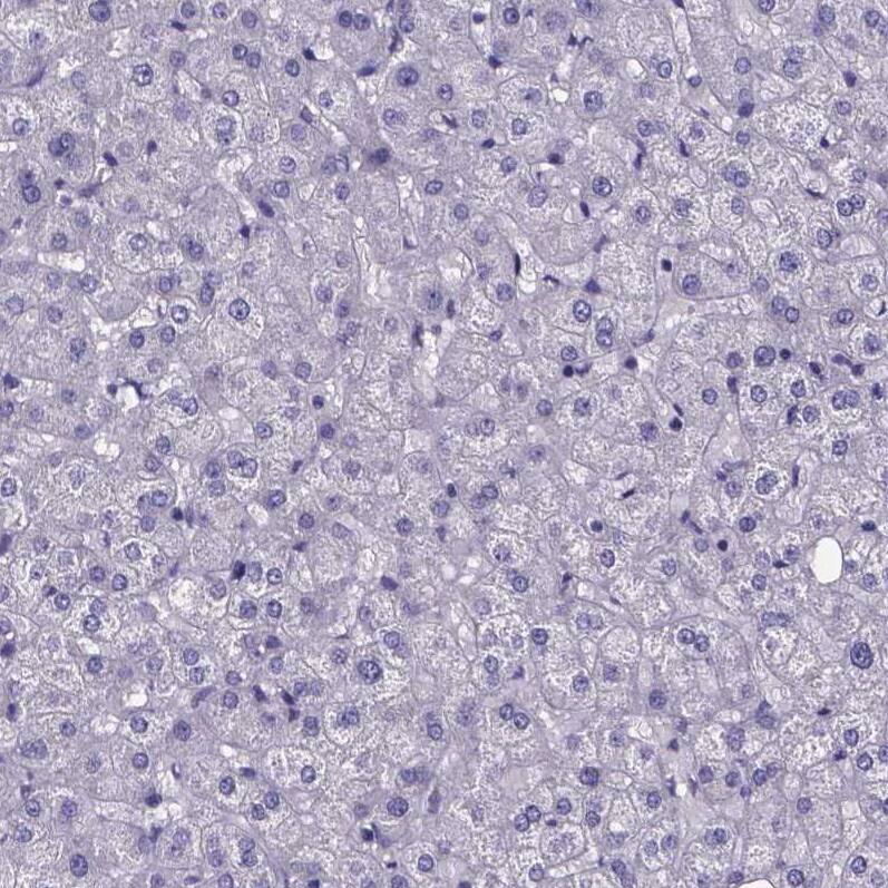 Staining of human liver shows no positivity in hepatocytes as expected.