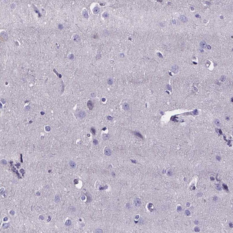 Staining of human cerebral cortex shows no positivity in neurons as expected.