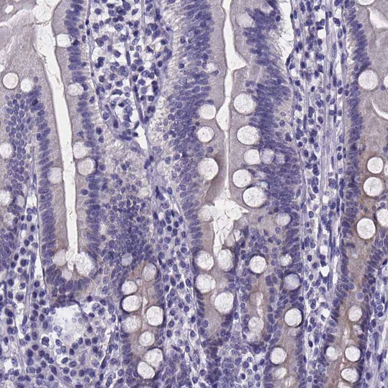 Staining of human duodenum shows no positivity in glandular cells as expected.