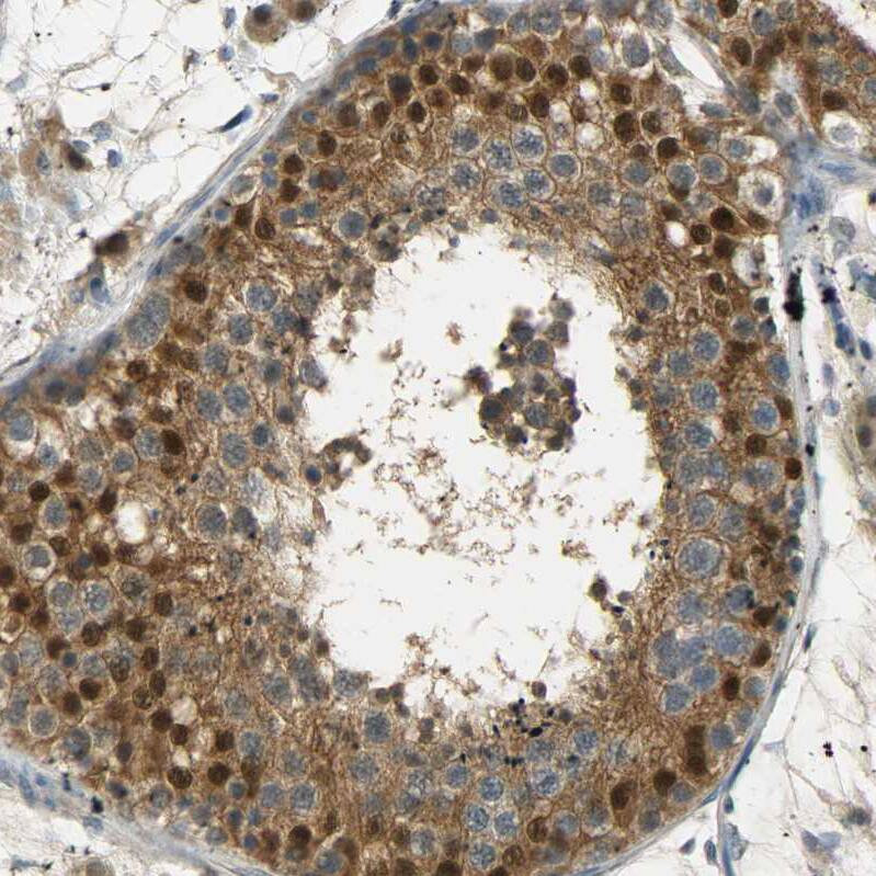 Immunohistochemistry-Paraffin USP13 Antibody - BSA Free