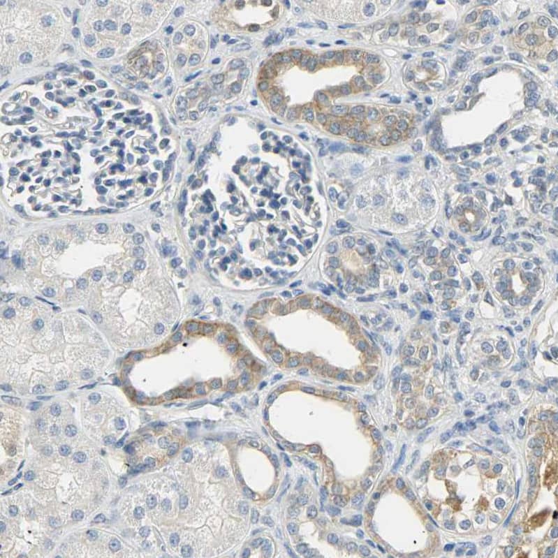 Immunohistochemistry-Paraffin USP13 Antibody - BSA Free