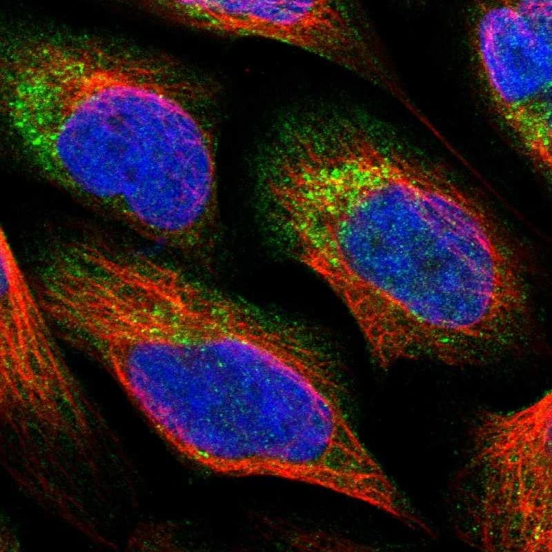 Immunocytochemistry/ Immunofluorescence PNPLA8 Antibody - BSA Free