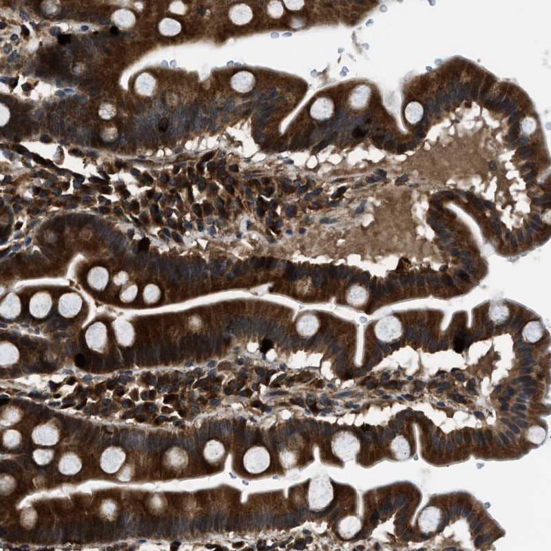 Immunohistochemistry-Paraffin PNPLA8 Antibody - BSA Free