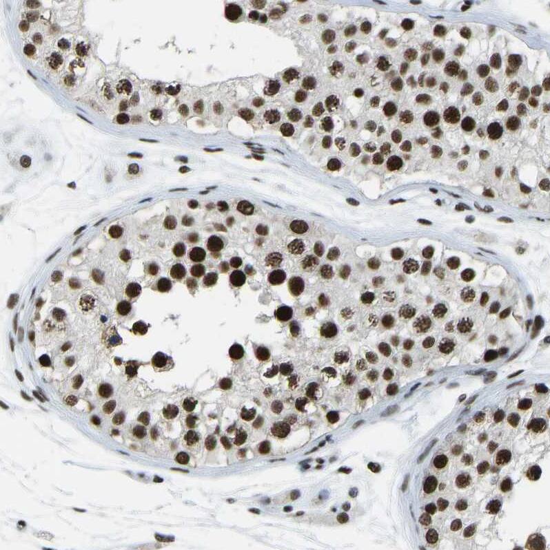 Staining of human testis shows moderate to strong nuclear positivity in cells in seminiferous ducts.