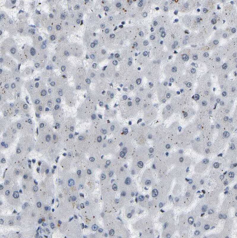 Staining of human liver shows no positivity in hepatocytes as expected.