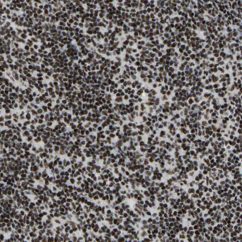 Staining of human lymph node shows moderate to strong nuclear positivity in non-germinal center cells.