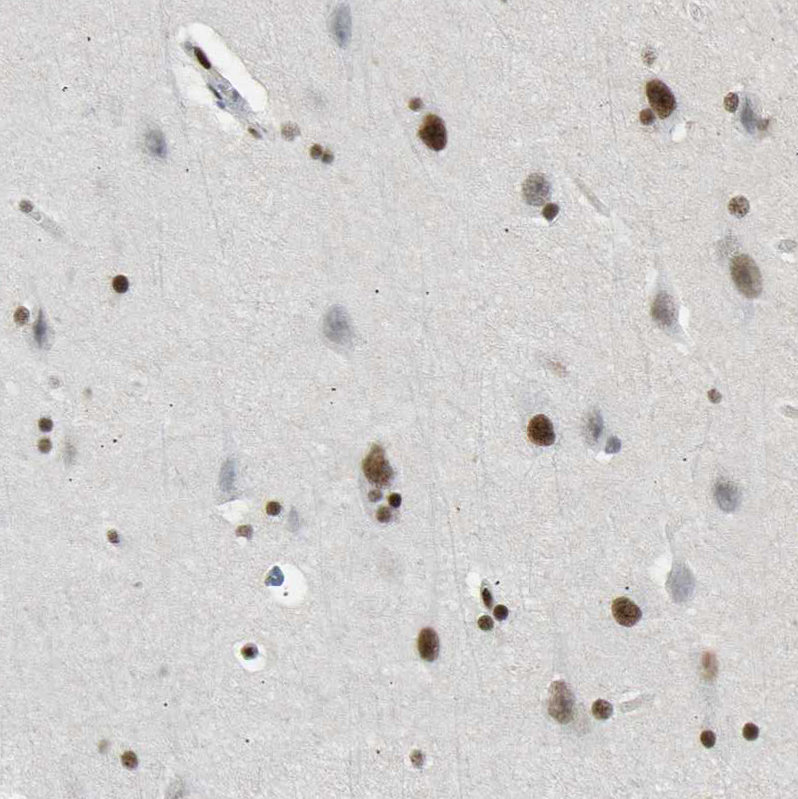 Staining of human cerebral cortex shows moderate to strong nuclear positivity in neurons.