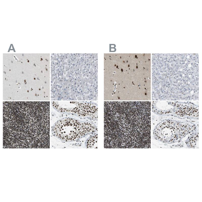 Staining of human cerebral cortex, liver, lymphoid tissues and testis HPA018864 (A) shows similar protein distribution across tissues to independent antibody HPA017998 (B).