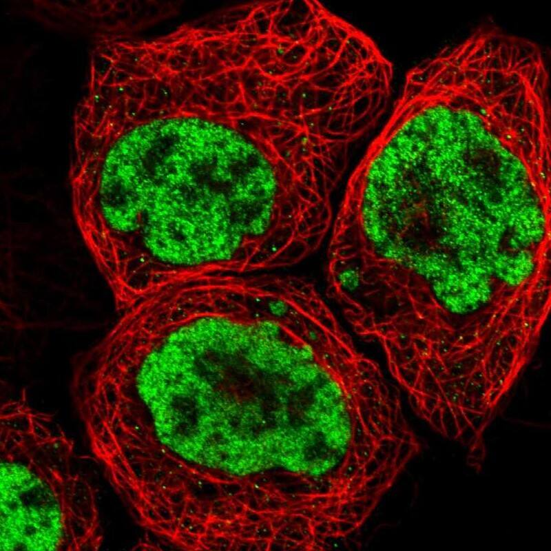 Staining of human cell line A-431 shows localization to nucleoplasm.