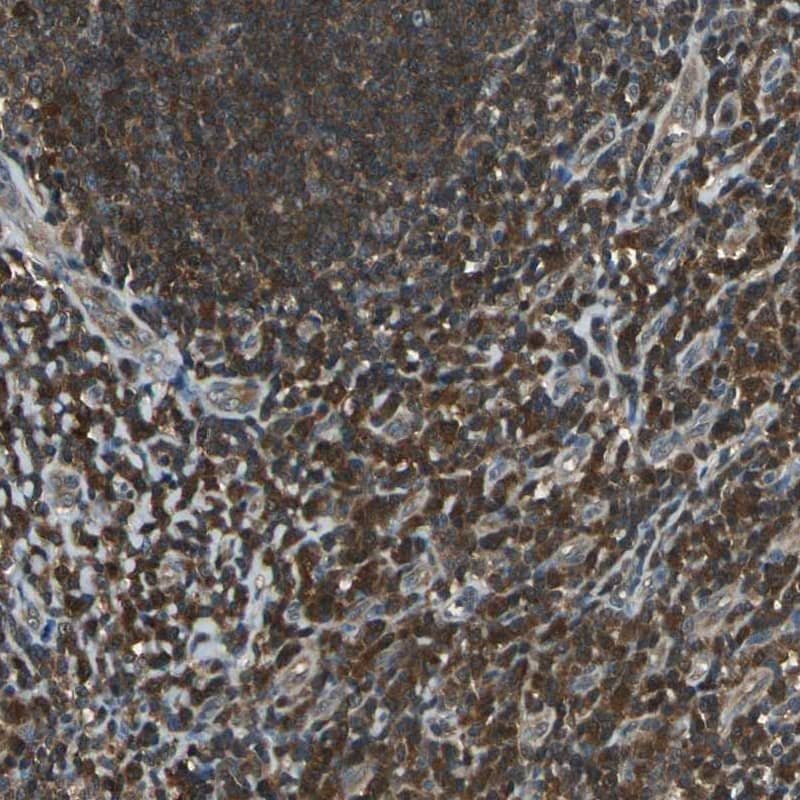 Immunohistochemistry-Paraffin PA28 Activator alpha Subunit/PSME1 Antibody - BSA Free