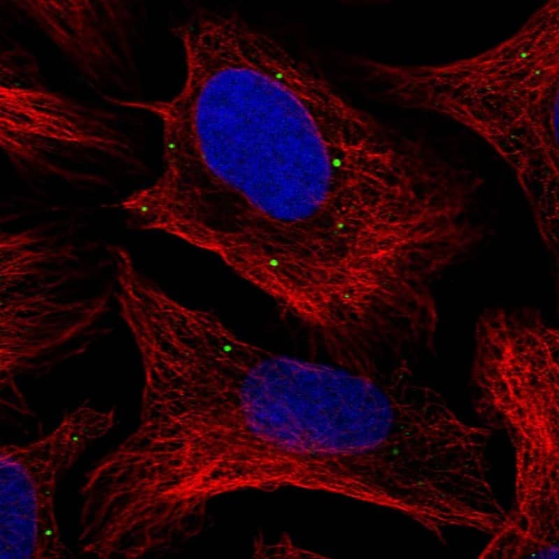 Staining of human cell line U-2 OS shows localization to vesicles.