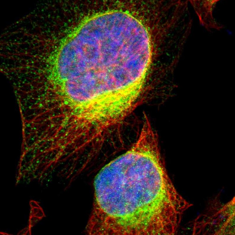Staining of human cell line U-2 OS shows localization to endoplasmic reticulum.