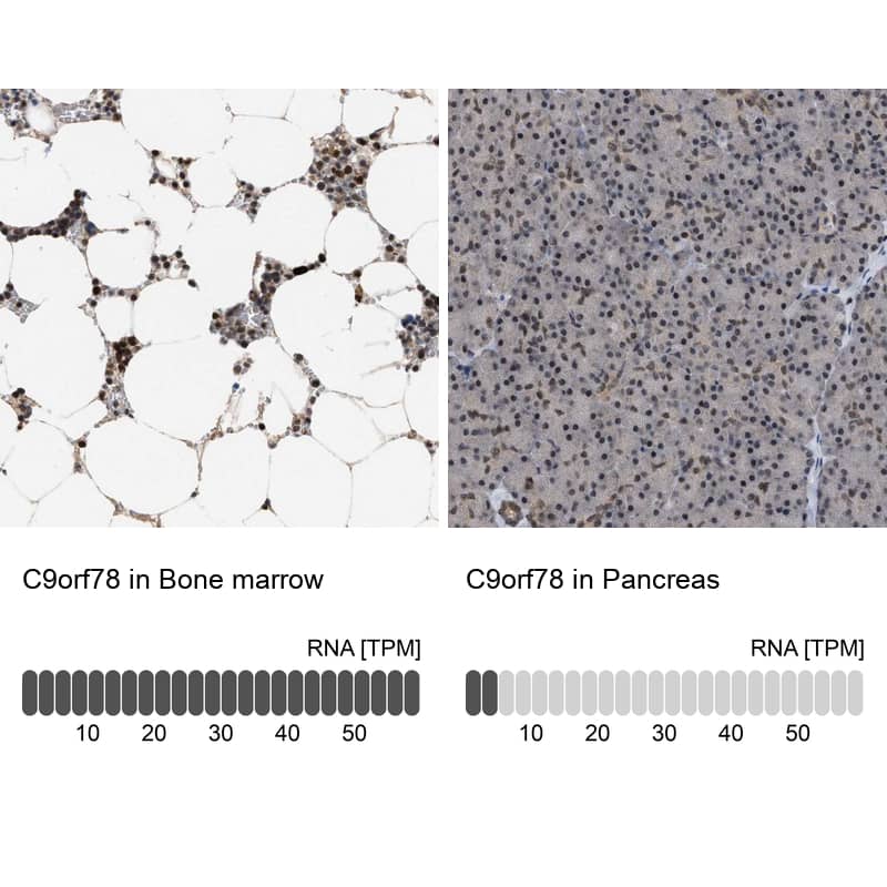 <b>Orthogonal Strategies Validation. </b>Immunohistochemistry: HCA59 Antibody [NBP1-83169] - Analysis in human bone marrow and pancreas tissues using NBP1-83169 antibody. Corresponding C9orf78 RNA-seq data are presented for the same tissues.