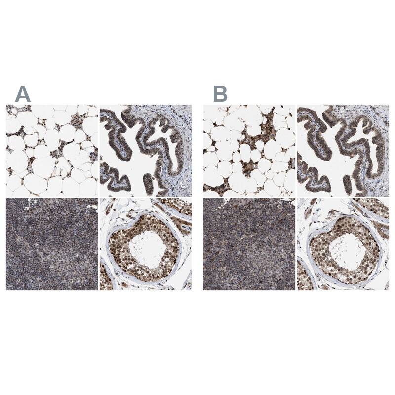 <b>Independent Antibodies Validation. </b>Immunohistochemistry: HCA59 Antibody [NBP1-83169] - Staining of human bone marrow, fallopian tube, lymph node and testis using Anti-C9orf78 antibody NBP1-83169 (A) shows similar protein distribution across tissues to independent antibody NBP1-83170 (B).