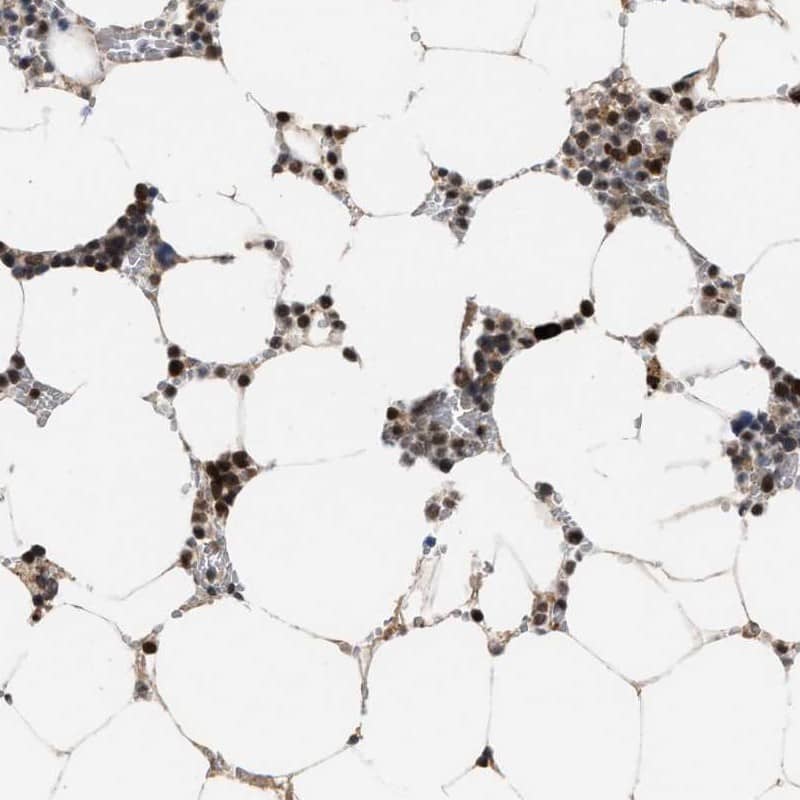 Immunohistochemistry: HCA59 Antibody [NBP1-83169] - Staining of human bone marrow shows high expression.