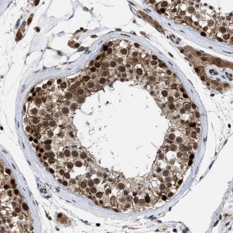 Immunohistochemistry: HCA59 Antibody [NBP1-83169] - Staining of human testis shows strong nuclear positivity in cells in seminiferous ducts.