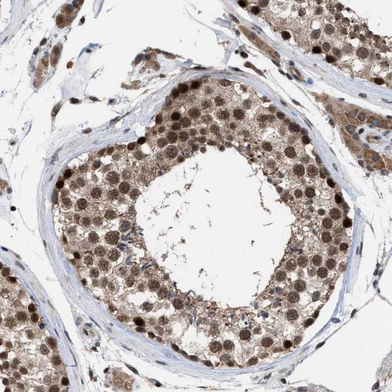 Immunohistochemistry-Paraffin HCA59 Antibody - BSA Free