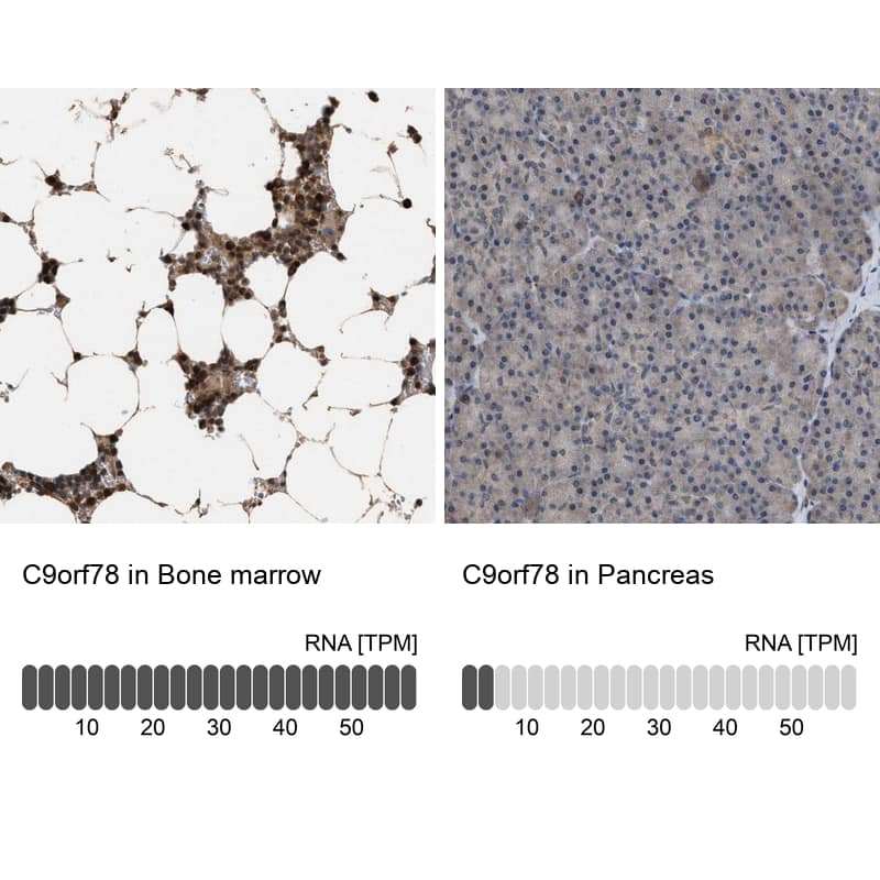 Immunohistochemistry-Paraffin HCA59 Antibody - BSA Free