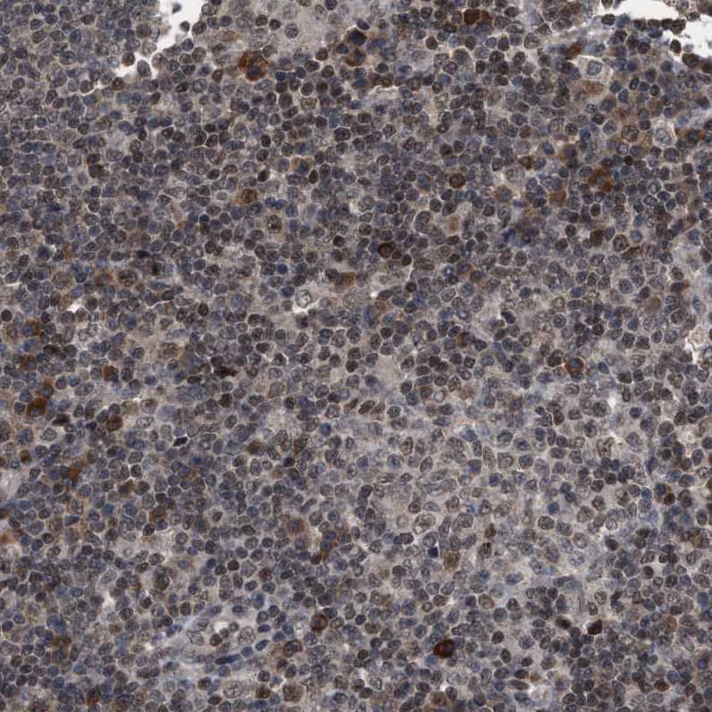 Immunohistochemistry-Paraffin HCA59 Antibody - BSA Free