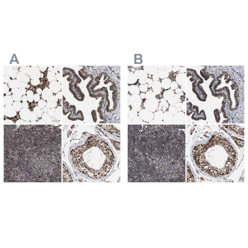Immunohistochemistry-Paraffin HCA59 Antibody - BSA Free
