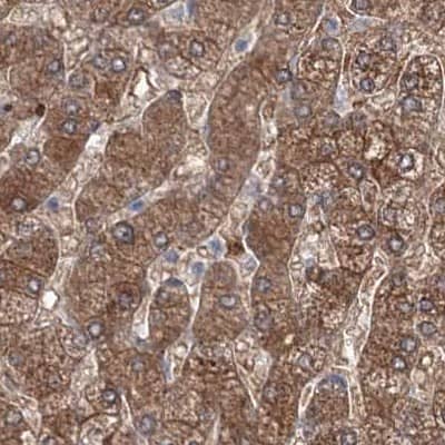 Staining of human liver.