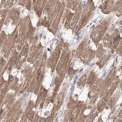 Staining of human heart muscle.