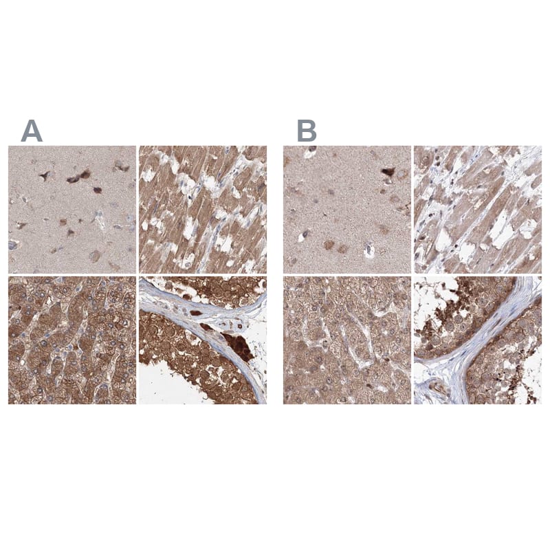 <b>Orthogonal Strategies Validation. </b>Staining of human cerebral cortex, heart muscle, liver and testis HPA037560 (A) shows similar protein distribution across tissues to independent antibody HPA037559 (B).