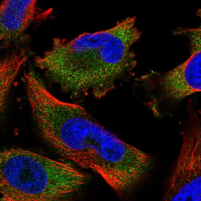 Staining of human cell line U-251 MG shows localization to cytosol.