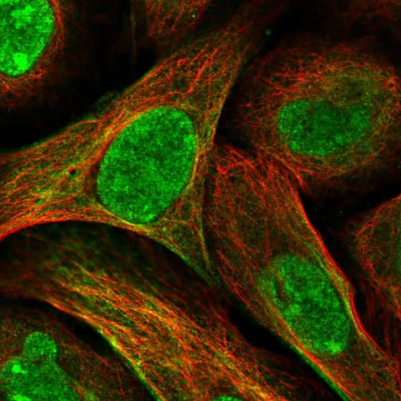 Staining of human cell line U-2 OS shows localization to nucleus, nucleoli, plasma membrane & cytosol.