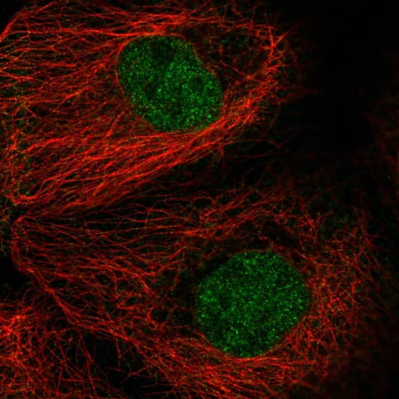 Staining of human cell line A-431 shows localization to nucleoplasm.
