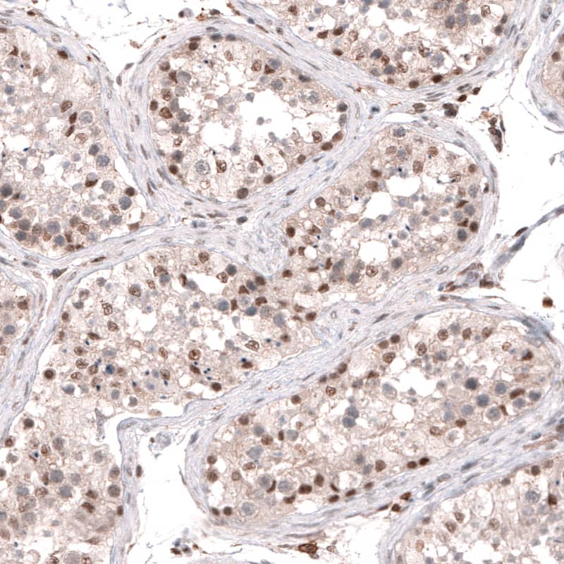 Staining of human testis shows moderate to strong nuclear positivity in a subset of cells in seminiferous ducts.