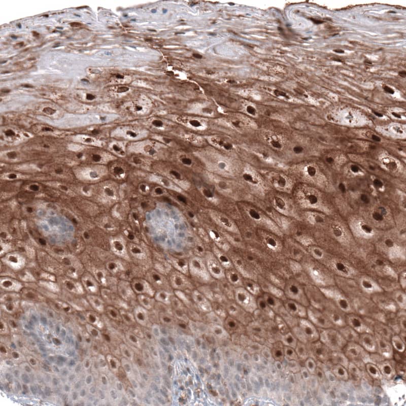 Staining of human uterine cervix shows moderate to strong nuclear positivity in squamous epithelial cells.