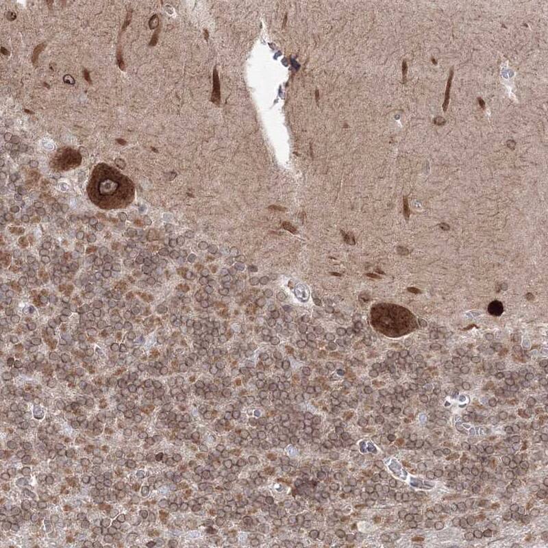 Staining of human cerebellum shows strong nuclear membrane and cytoplasmic positivity in Purkinje cells.