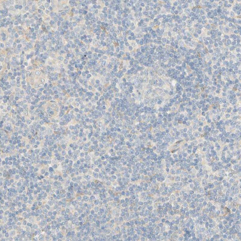 Staining of human tonsil shows no positivity in non-germinal center cells as expected.