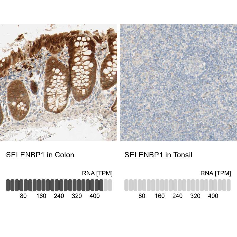<b>Orthogonal Strategies Validation. </b>Analysis in human colon and tonsil tissues. Corresponding RNA-seq data are presented for the same tissues.