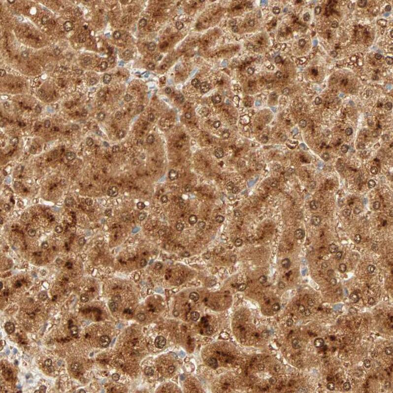 Staining of human liver shows strong cytoplasmic and nuclear positivity in hepatocytes.