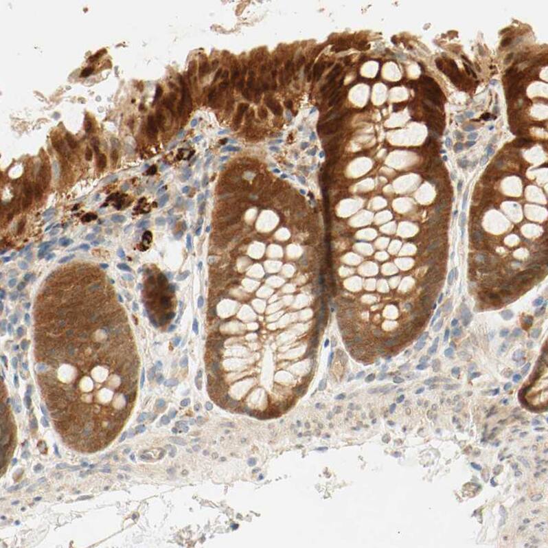 Staining of human colon shows strong cytoplasmic positivity in glandular cells.