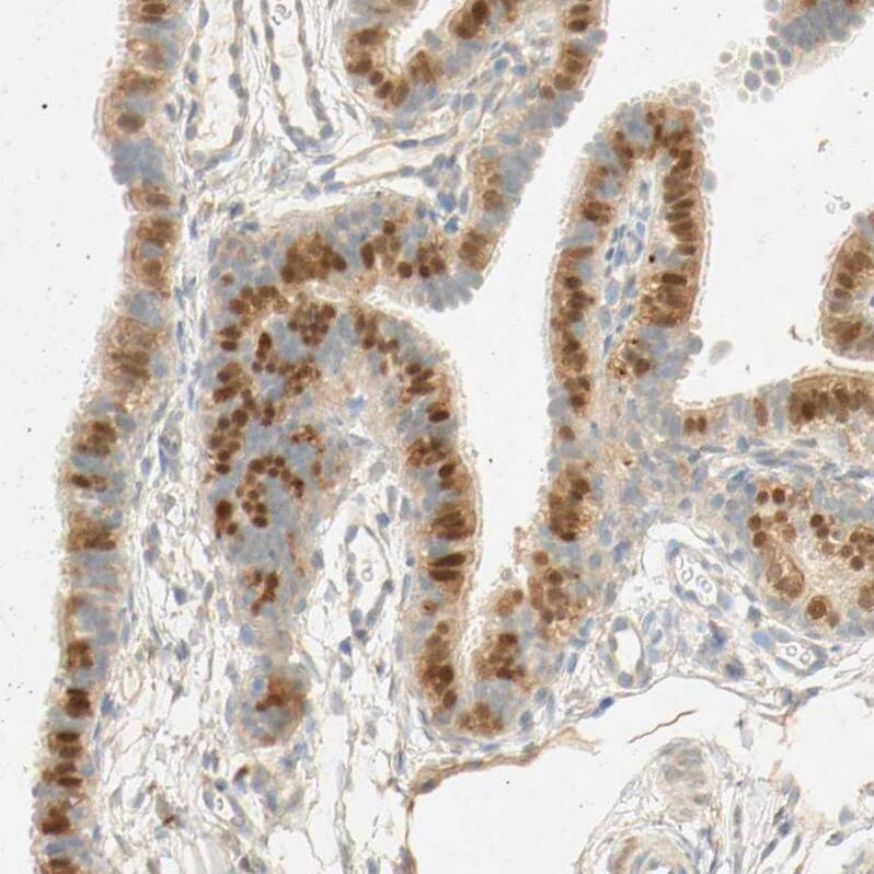 Staining of human Fallopian tube shows weak to moderate nuclear positivity in glandular cells.