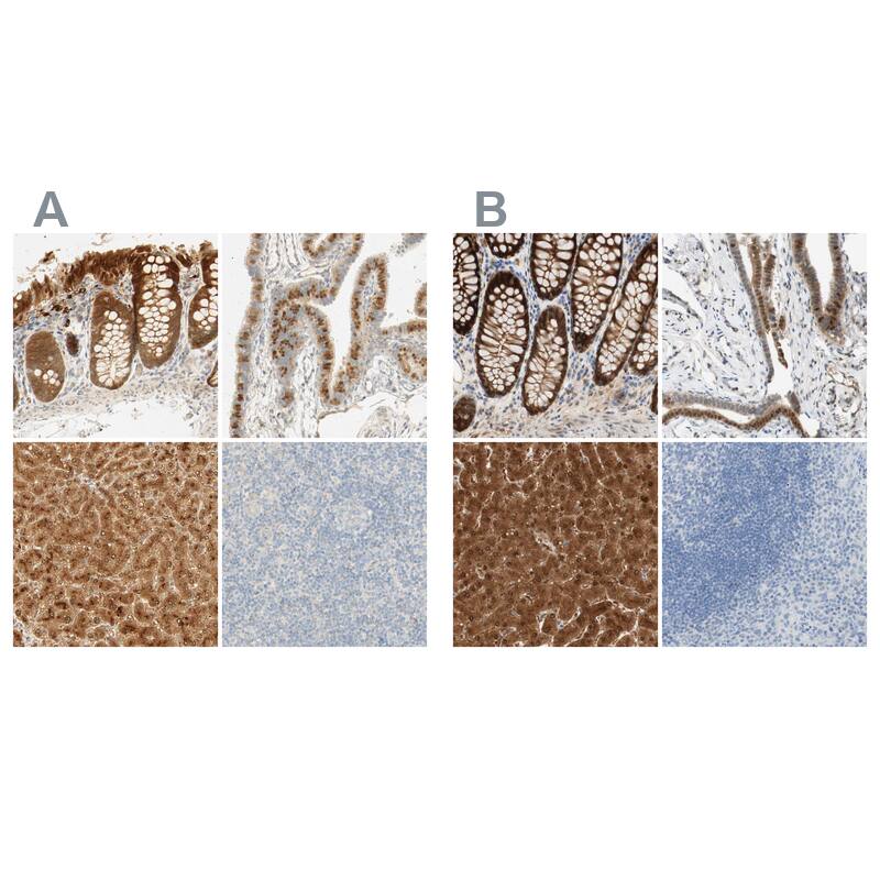 <b>Orthogonal Strategies Validation. </b>Staining of human colon, fallopian tube, liver and tonsil HPA005741 (A) shows similar protein distribution across tissues to independent antibody HPA011731 (B).