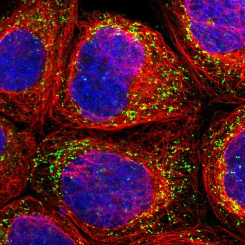 Staining of human cell line A-431 shows localization to peroxisomes.