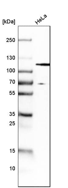 Analysis in human cell line HeLa.