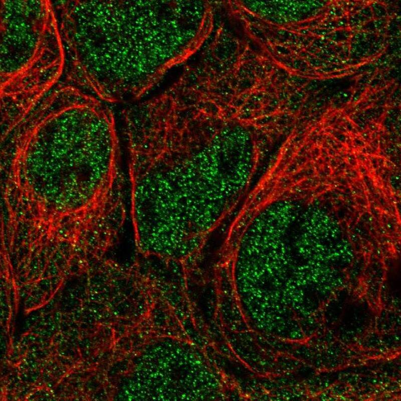 Immunocytochemistry/ Immunofluorescence PRMT2 Antibody - BSA Free