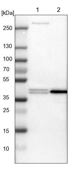 Lane 1: NIH-3T3 cell lysate (Mouse embryonic fibroblast cells))Lane 2: NBT-II cell lysate (Rat Wistar bladder tumour cells))