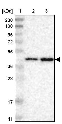 Lane 1: Marker [kDa] 230, 130, 95, 72, 56, 36, 28, 17, 11Lane 2: Human cell line RT-4Lane 3: Human cell line U-251MG sp