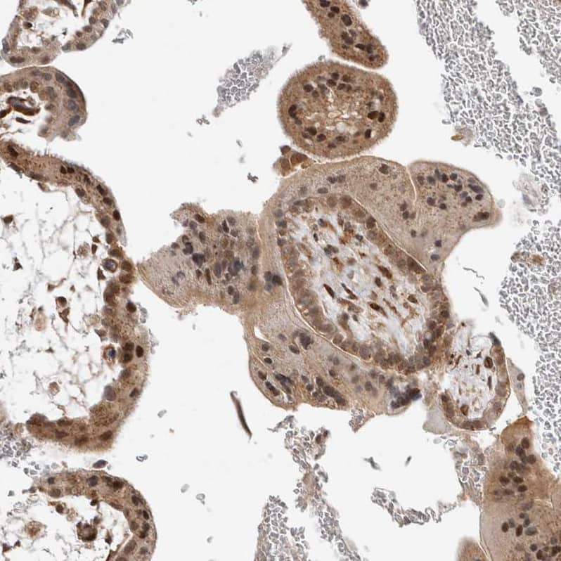Staining of human placenta shows moderate nuclear and cytoplasmic positivity in trophoblastic cells.