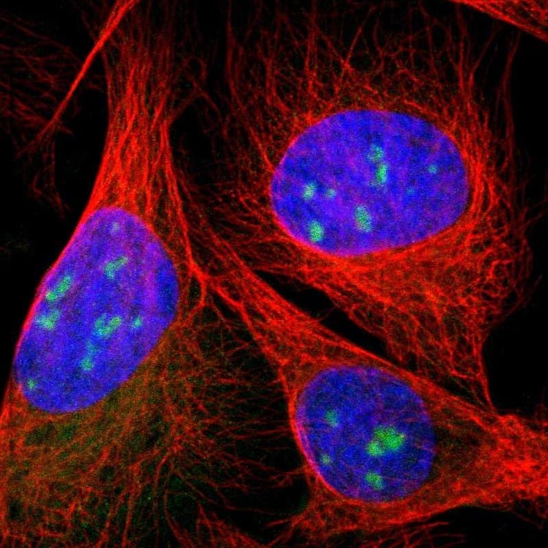 Immunocytochemistry/ Immunofluorescence DDX10 Antibody - BSA Free