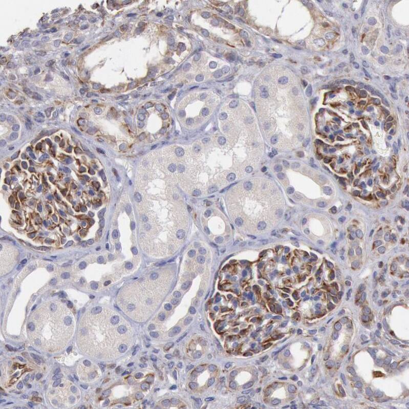 Staining of human kidney shows strong cytoplasmic positivity in cells in glomeruli.