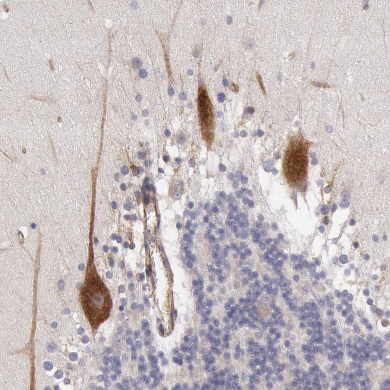 Staining of human cerebellum shows strong cytoplasmic positivity in Purkinje cells.