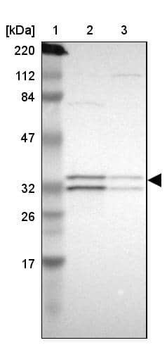 Lane 1: Marker [kDa] 220, 112, 84, 47, 32, 26, 17Lane 2: Human cell line RT-4Lane 3: Human cell line U-251MG sp